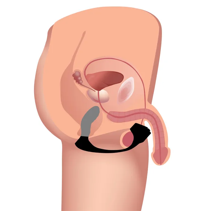 Trinity Men Male Sex Toys 7X Silicone Prostate Plug with Ball Stretcher and Remote